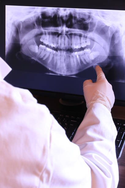 Best Emergency Denture Repair in Bothell, WA