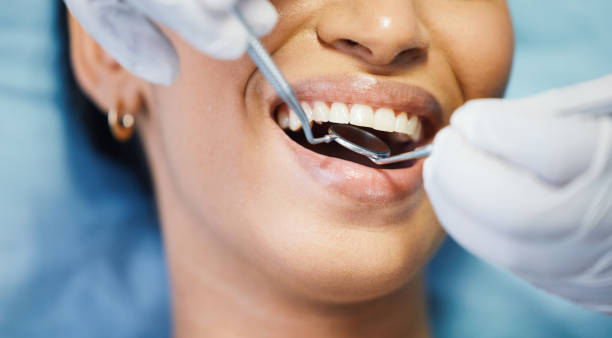 Best Emergency Gum Treatment in Bothell, WA