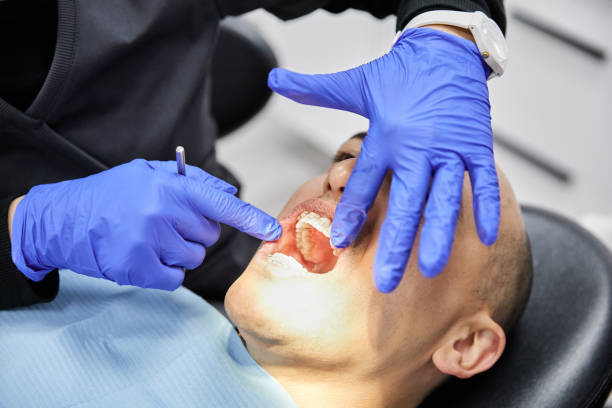 Best Emergency Gum Treatment in Bothell, WA